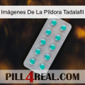 Imágenes De La Píldora Tadalafil 28